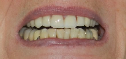 Een klant met het verzoek voor gezonde, mooie mond met tanden 