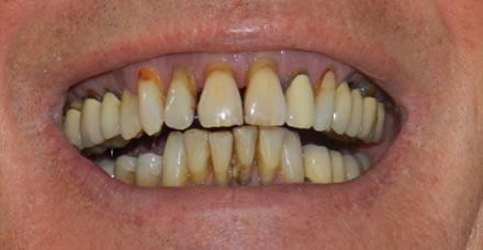 Een klant met het verzoek voor gezonde, mooie mond met tanden 